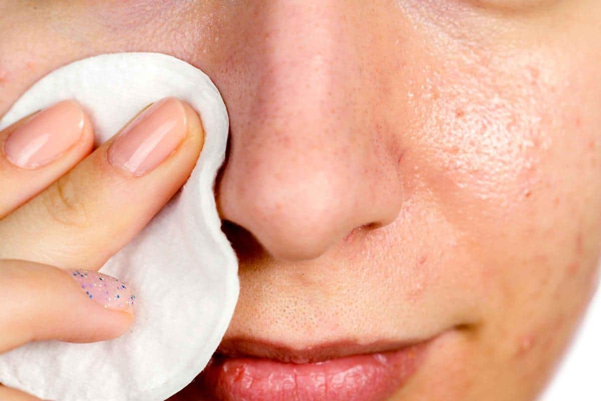 Skincare Lokal untuk Menghilangkan Komedo dan Mengecilkan Pori-Pori