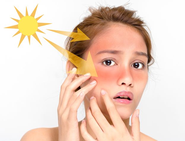 Alasan Harus Memakai Sunscreen